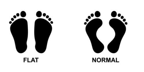 Flat Feet Vs. Normal Feet Imprint